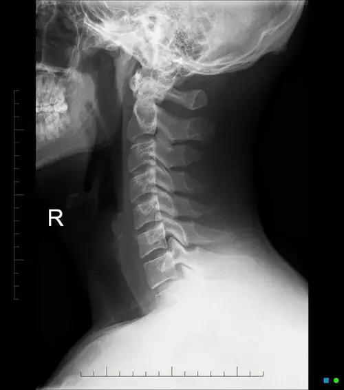 digital xray digital xray