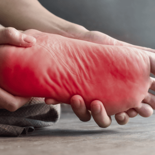 Neuropathy